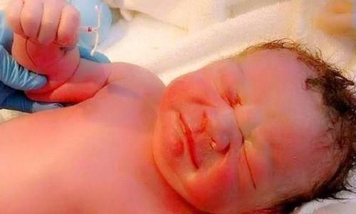 新生儿|助产大夫被新生儿“碰瓷”,网友调侃这么记仇,长大后不好惹