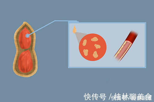 高血脂|花生的营养被低估?每天吃多少花生,能起到养生效果?有答案了