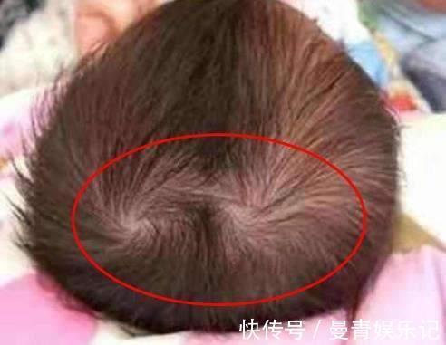 毛发|为什么有的孩子头上有“2个旋”?代表什么意思,父母要知道