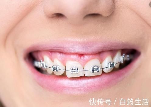 牙齿|孩子换牙齿,新长的牙齿却是歪的,可能是家长这些没做好