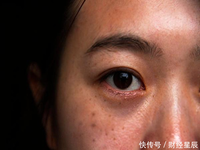 干燥|双脚是肝脏健康的“晴雨表”,连续出现这3种异常,肝病来袭