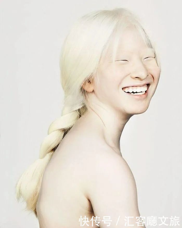 逆袭|因“全身雪白”被遗弃的中国女孩,逆袭成超模的故事让人泪目