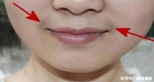 白带异常|女人是否有妇科病,看嘴就知道,健康的女性一般没有这4个异常