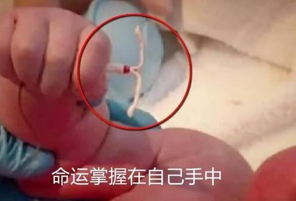 宝宝|“霸气宝宝”走红，手紧握着避孕环出生，网友：命运掌握自己手里