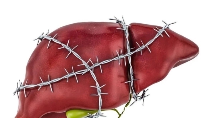 老李|53岁大叔查出肝癌，2月后离世，医生：1道下酒菜是祸根，铁打的肝都遭不住