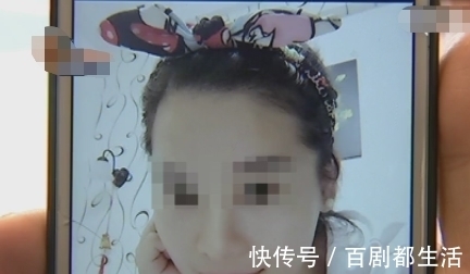 罗女士 女子花9万做整容，术后工作感情都受到影响