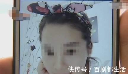 罗女士 女子花9万做整容,术后工作感情都受到影响