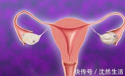 腺肌病|子宫好的3个表现，晨起时若有，恭喜，子宫是健康的