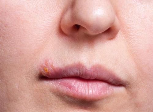 嘴唇干燥起皮,或是这5个原因,很多人都没注意!