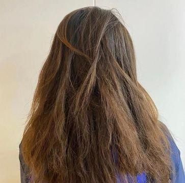 中老年人|原来头皮也会衰老?麦吉丽提出头皮衰老论,这么多年头发白洗了!