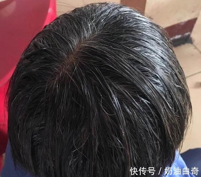 白头发|人的头发为什么会变白?不一定是年龄,知道这几点之后让你白变黑
