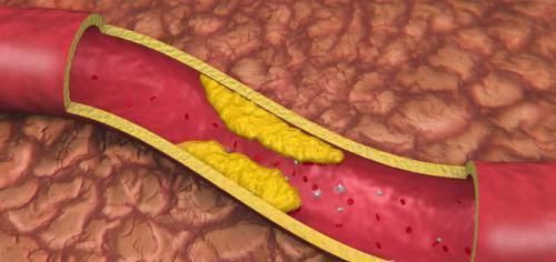 女性|女性开始衰老，有3处变硬，2处变粗，若没有，说明还年轻
