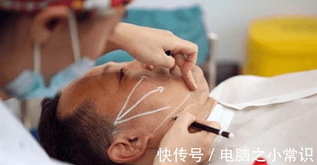 高光点 都说做拉皮手术不能太早,可我还是动心了!