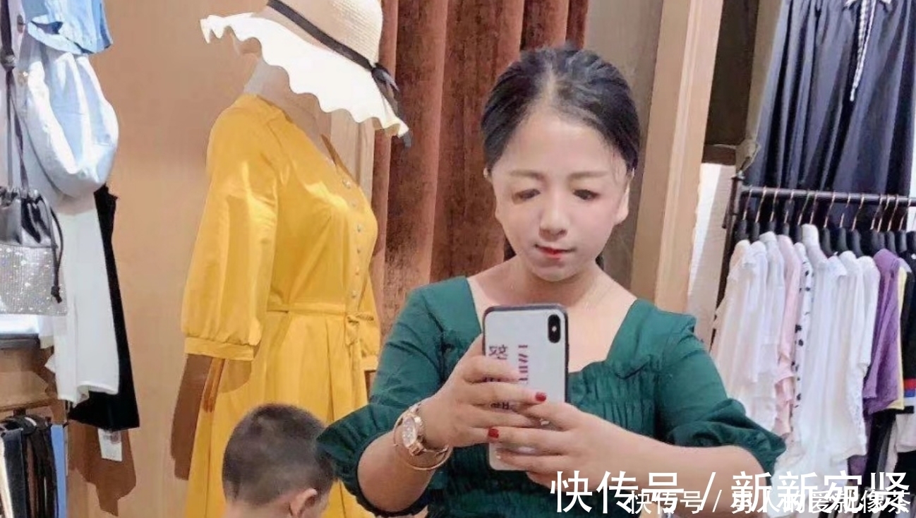 遗传性|“鸟脸”妈妈执意生“二胎”，产下孩子容貌引争议，如今后悔了!