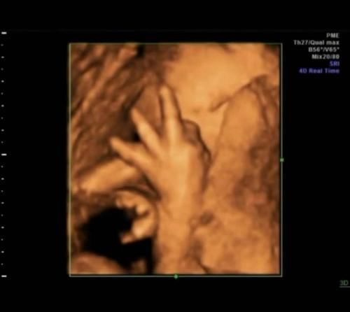 产妇|产妇产检做“四维”,胎儿在子宫里“数数”医生:下一个数学天才