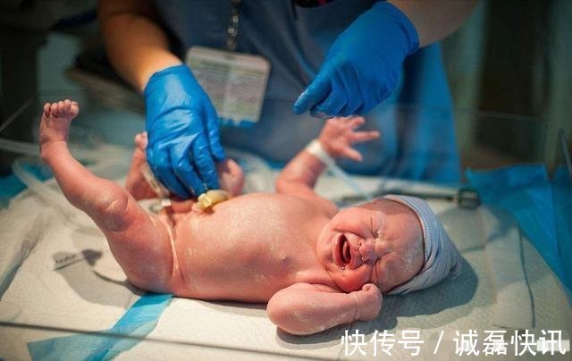 宝宝|胎儿刚出生就哭了,是因为剪脐带很疼吗?很多妈妈还不知道