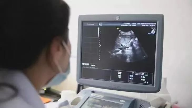 血流|2年没复查，息肉变成癌！B超报告里出现“这些字眼”可能就危险了，别等严重时才后悔