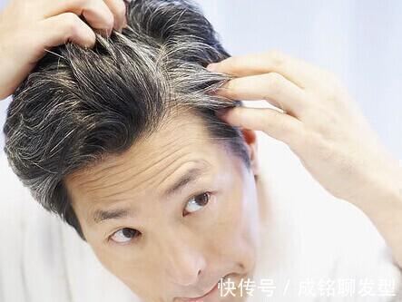 色素 经常染发会导致白发越来越多？染发只针对头发的，白发是身体原因