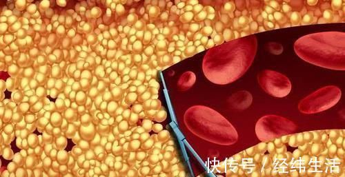 胆固醇|天然“降脂药”找到了，经常吃一些，清洁血管，血脂悄悄降下来