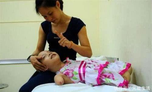 孕检|孕检发现孩子没手没脚,宝妈不顾医生劝阻坚持生,如今活成小公主