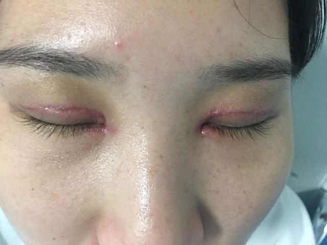 美女|曾经那些割了双眼皮的美女,10年后会变啥样,看完还敢割吗?