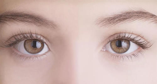 双眼皮能揉出来?3岁男童视网膜脱落,只因妈妈的“双眼皮执念”