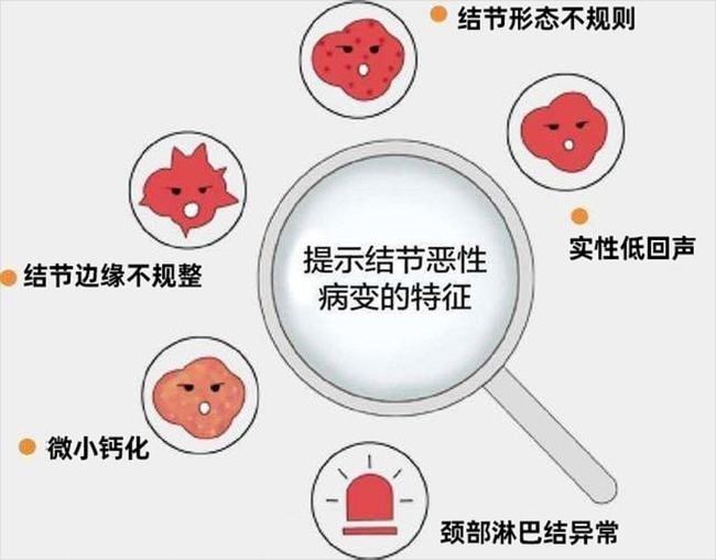 实性|预告丨甲状腺结节要紧吗？快看看超声报上的这些关键词