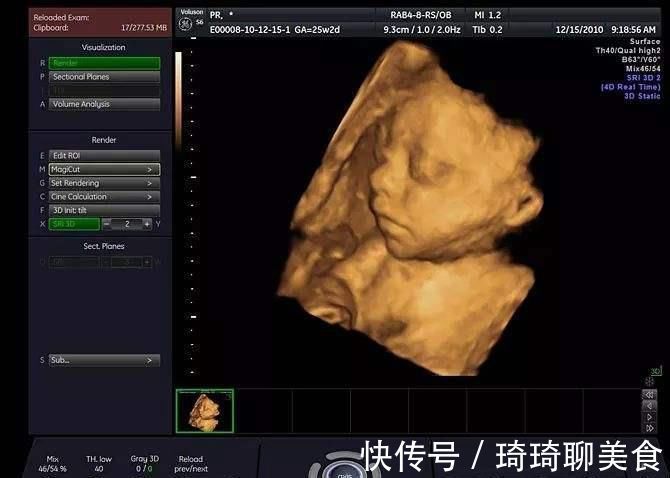 胎儿|孕妇做四维彩超,胎儿鼻子扁又大,胎儿也是有苦说不出啊!