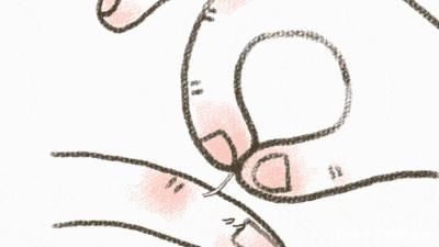 截肢|一个手贱,姑娘整片指甲盖都被拔了…还有人因此截肢!