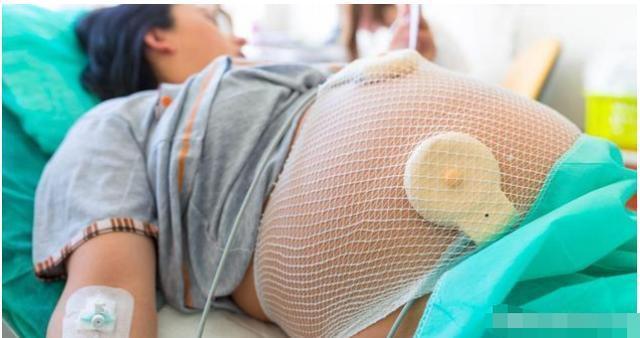 重症监护室|女子怀孕11个月还不发动,医生强行剖腹,孩子出生后全家泣不成声