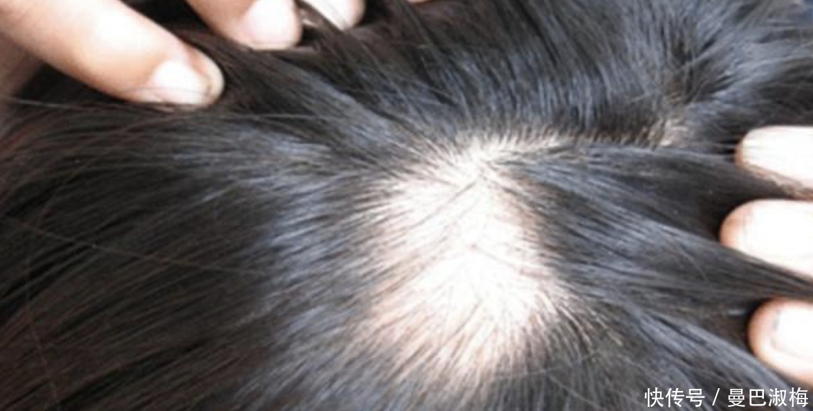 为什么头发每天一洗还很油,多久洗一次才好?原来这么多年都错了