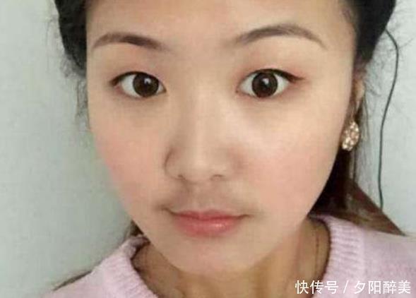  a686|为何有些女生的嘴唇上会长出“胡子”意味着什么早知早受益