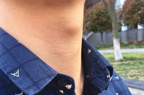 女性|喉结有什么作用吗为什么男性有,而女性却没有看完涨知识了