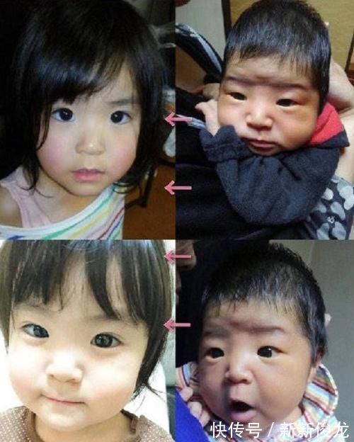 新生儿|新生儿像“小老头”?别失望,日本父母亲身证明“娃大十八变”!