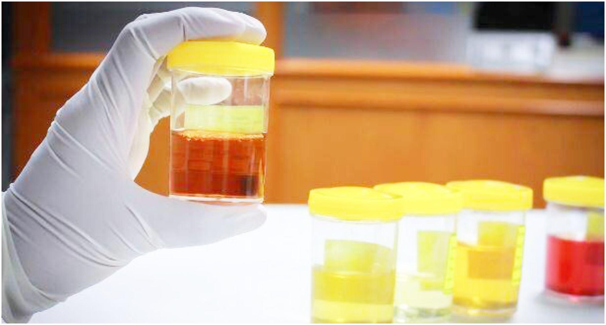 糖尿病|天然“降糖冠军”找到了,不是苦瓜,平时敞开喝,糖尿病不告而别