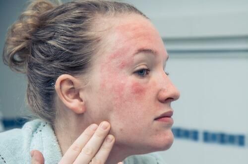 让皮肤变差的3种护肤方式，真的，你还不如只用清水洗脸