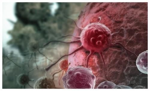 逐渐性|肺癌在“上身”之前,身体也许会亮起几个红灯,早知,早治,早好