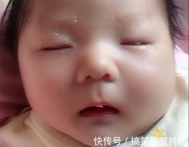 头部|3个月内宝宝睡觉时,家长要清楚3件事,以免影响宝宝发育