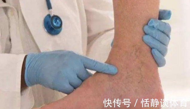 脚部|血糖高的人，大多有四个习惯，脚部若出现三个表现，是有并发症了