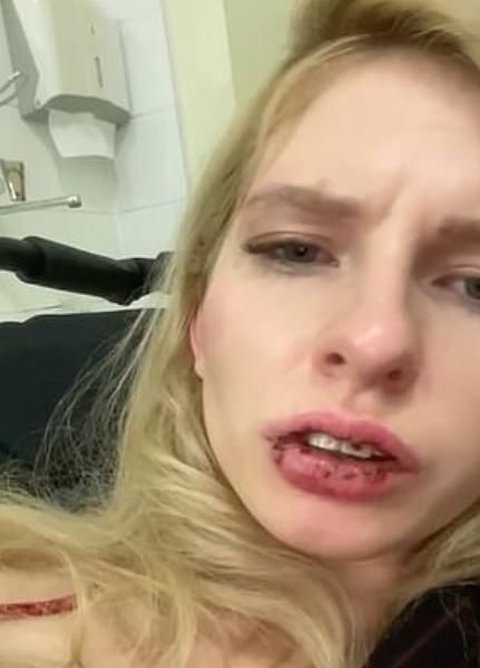 网红男主播直播时突然暴揍模特女主播，头破血流，全程被围观