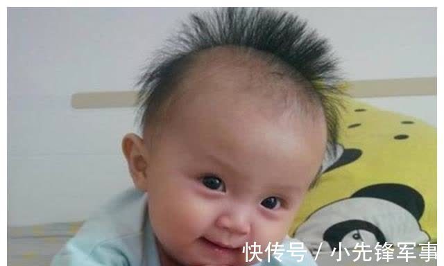 斑秃|娃的头发是发育的“标准”，发多发少家长要有数，关乎宝宝的健康