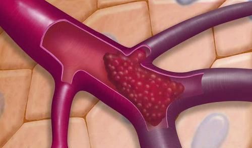 血液流|血液垃圾的“天敌”找到了,每天吃一点,清理血管,恢复年轻态