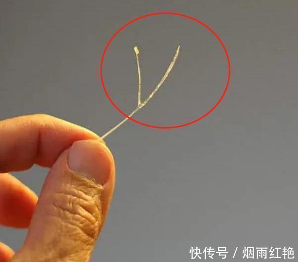 孙子|4岁男孩被鱼刺卡喉,奶奶“两招”救了孙子,医生:姜还是老的辣