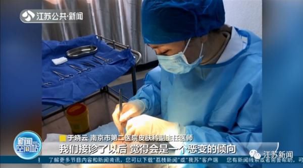 激光|男子脸上痣突然增大，一查竟是癌！这些部位有痣的人要注意！