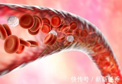 血液|天然的“腦梗藥”找到了，拿3顆泡水喝，不出一個月，血栓消失了