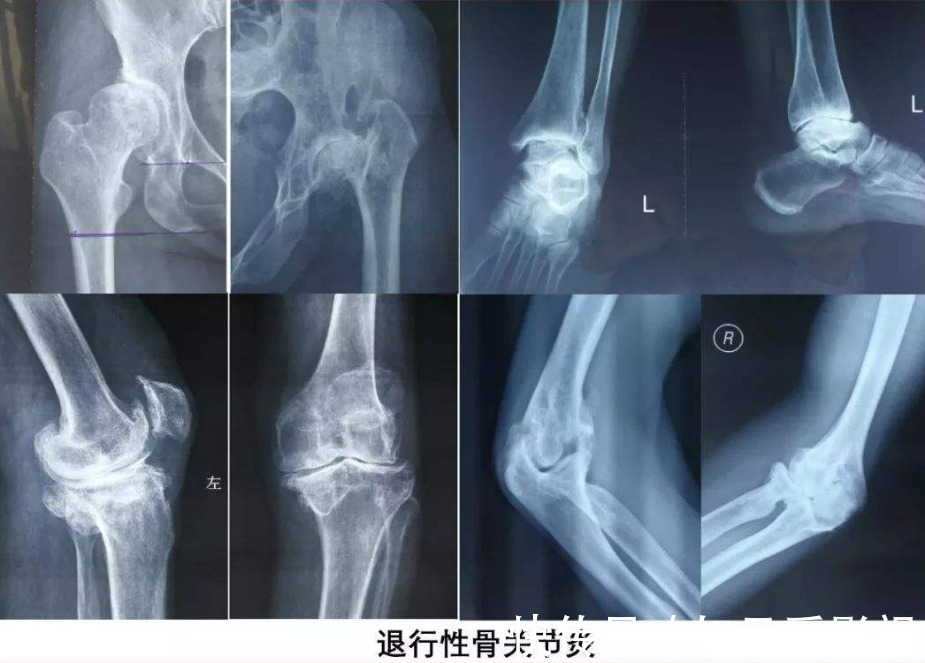 偏方|民间土偏方：“豆浆+南瓜”一起煮，一周喝3次，膝盖不疼了