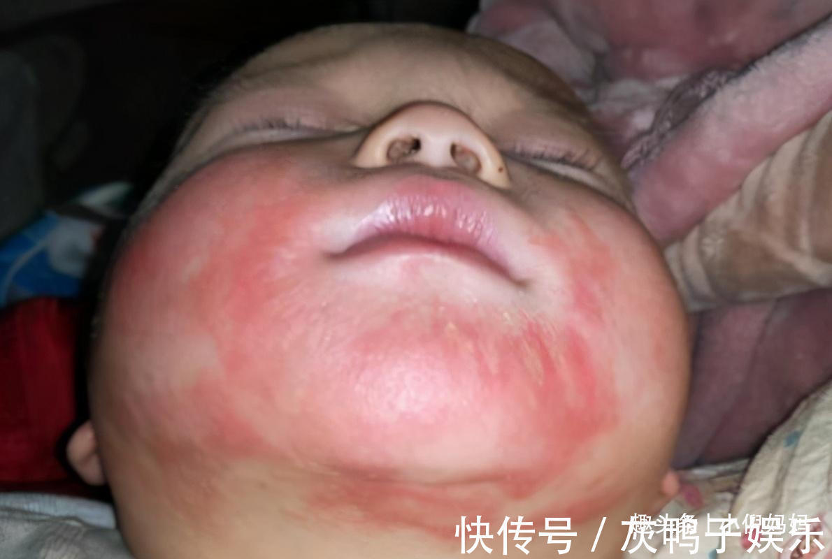 小雨|儿科医生建议最好别给宝宝吃鸡蛋羹,还在喂的家长,需要注意