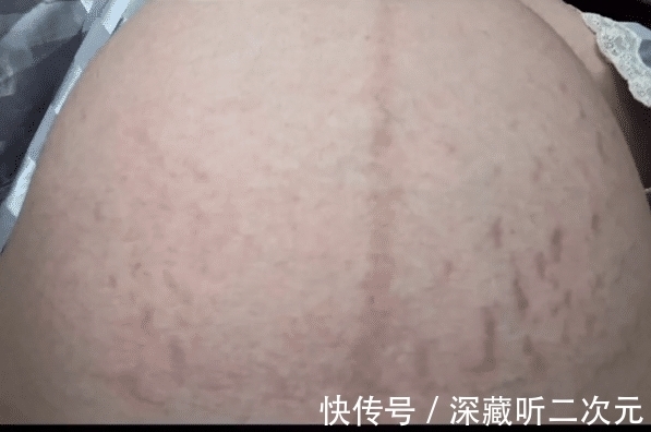 小猪先生|兜儿孕35周做产检,因长妊娠纹哭了好久,透露吨吨重4斤多