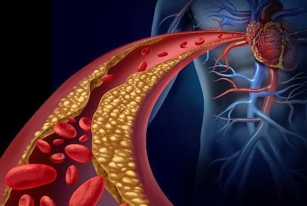 健康|血管洗个澡,健康活到老,不妨每天“洗”1次,早知早受益