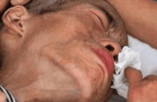 腾讯网|一家四口全部患有癌症, 只因炒菜的时候放了此物